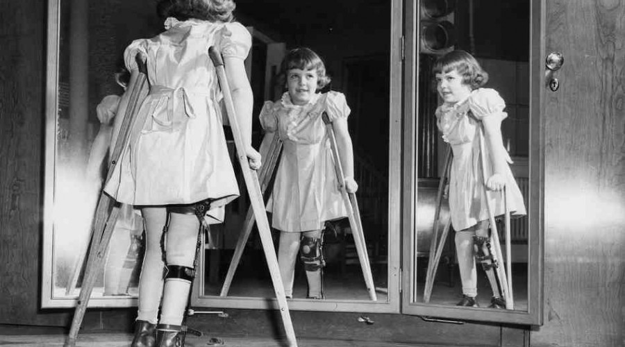 Post-Polio Syndrome